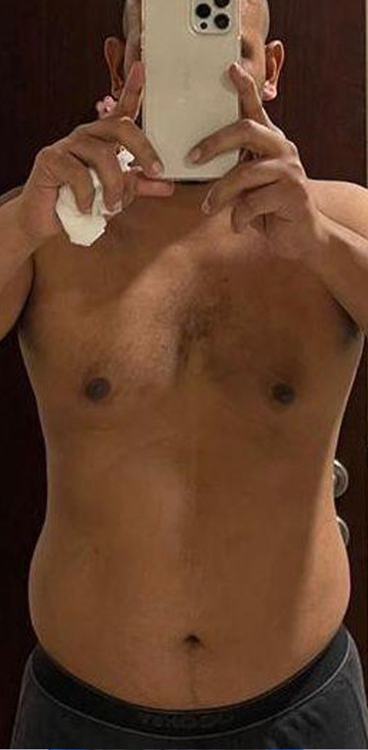 Mohd Nifu Before Transformation